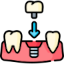 dental_implant